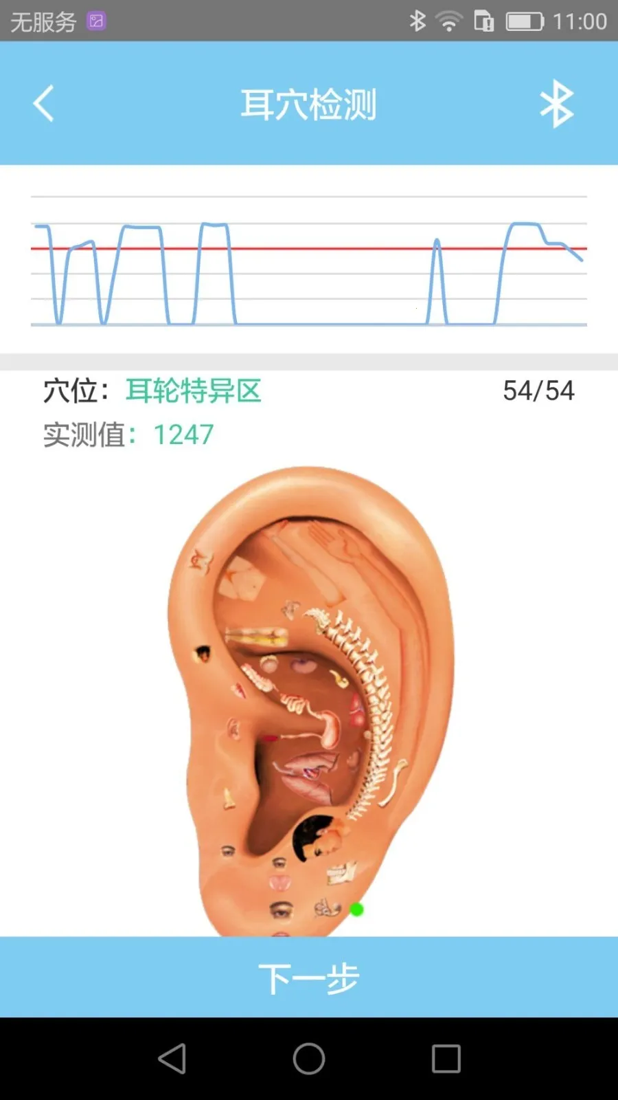 �����ж�Ѩ��������ֻ���v1.400 �ٷ������ͼ