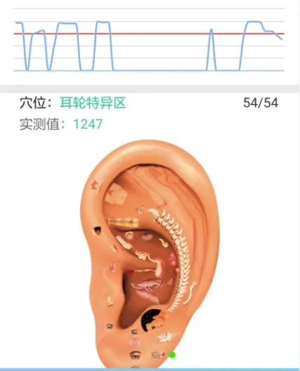 �����ж�Ѩ��������ֻ���